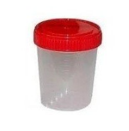 Nádoba na moč 100 ml sterilní 1ks